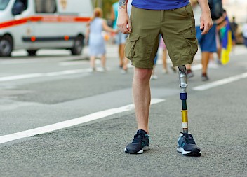 1.1 Million for Claimant Who Lost His Leg to Amputation