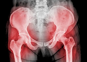 Orthopaedic Cases