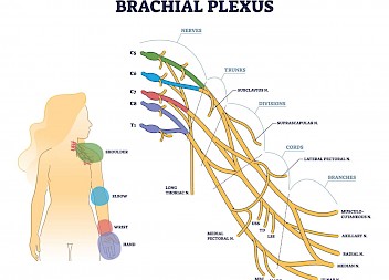 £348,600 for Brachial Plexus Nerve Injury at Birth