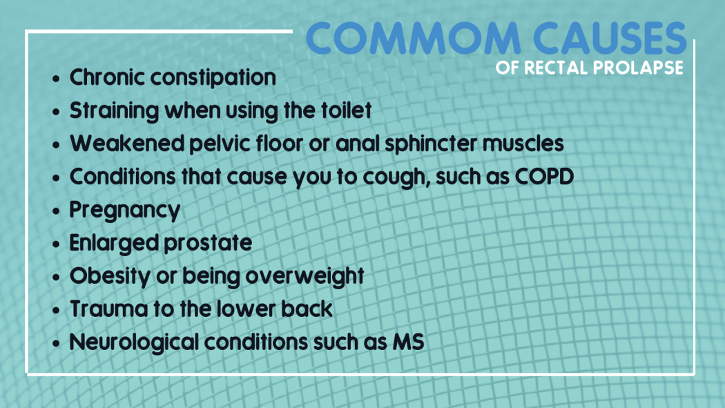 Infographic showing a list of common causes for rectal prolapse.