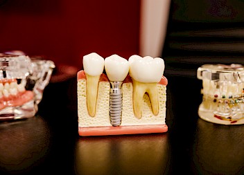 Dental Case Studies