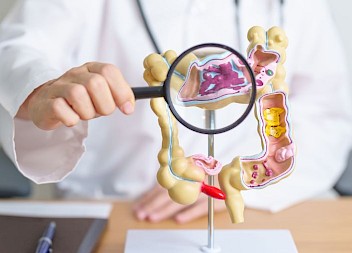 Bowel Cancer Negligence: Why Early Detection Matters