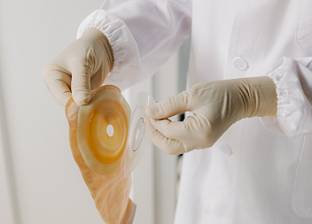 Surgical Error in Bowel Cancer Patient Leads to Fatal Outcome